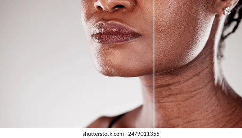Anti-Aging Facial